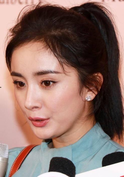 明星疤痕是怎么弄掉的